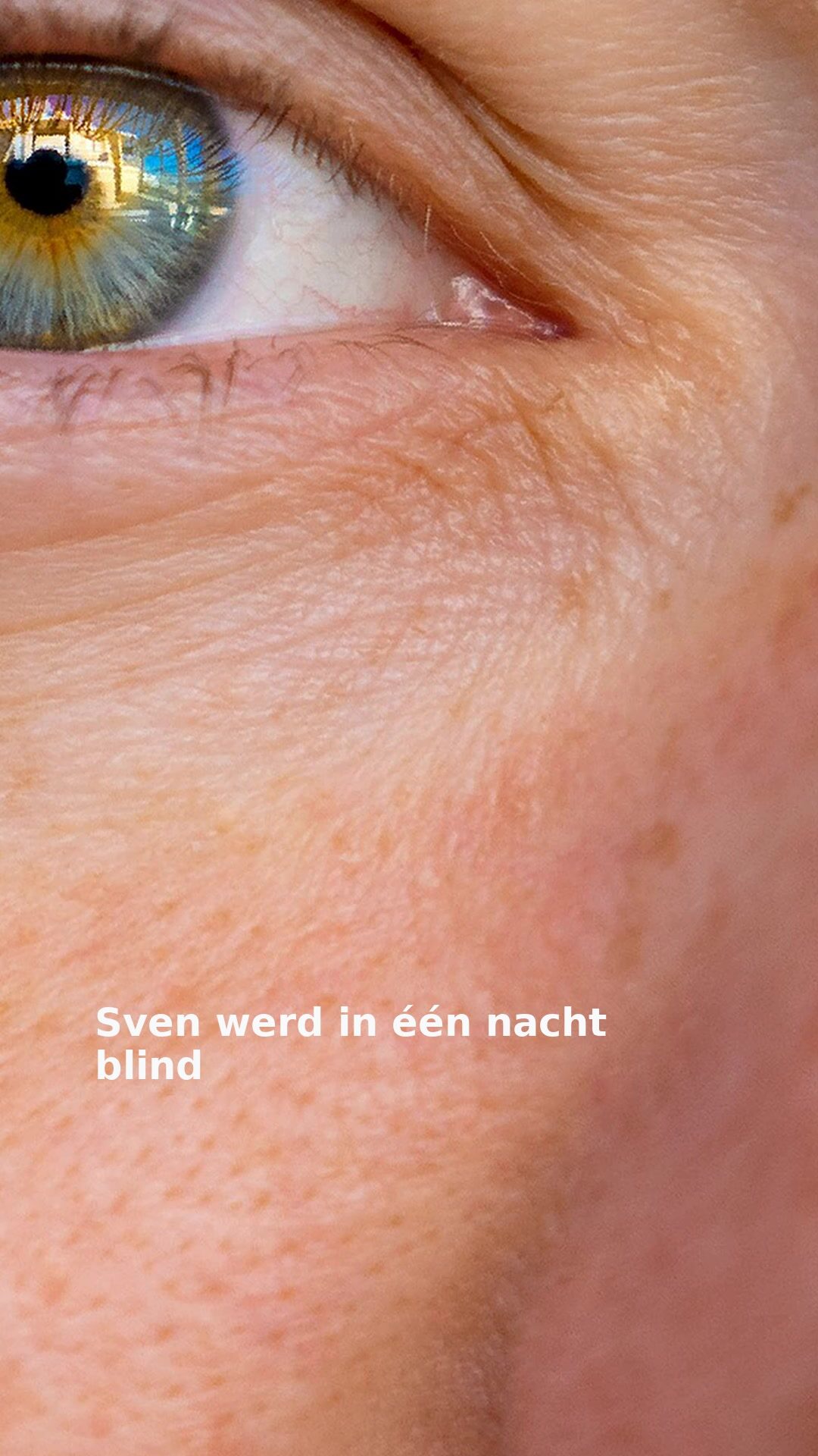 Sven werd in één nacht blind