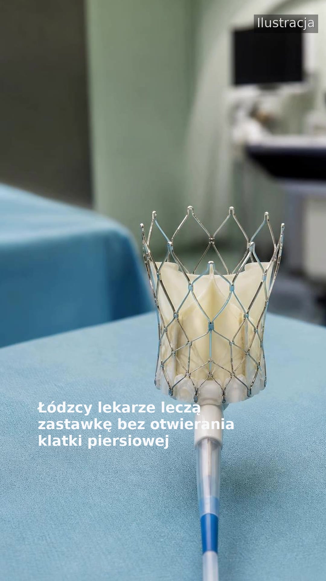 Łódzcy lekarze leczą zastawkę bez otwierania klatki piersiowej