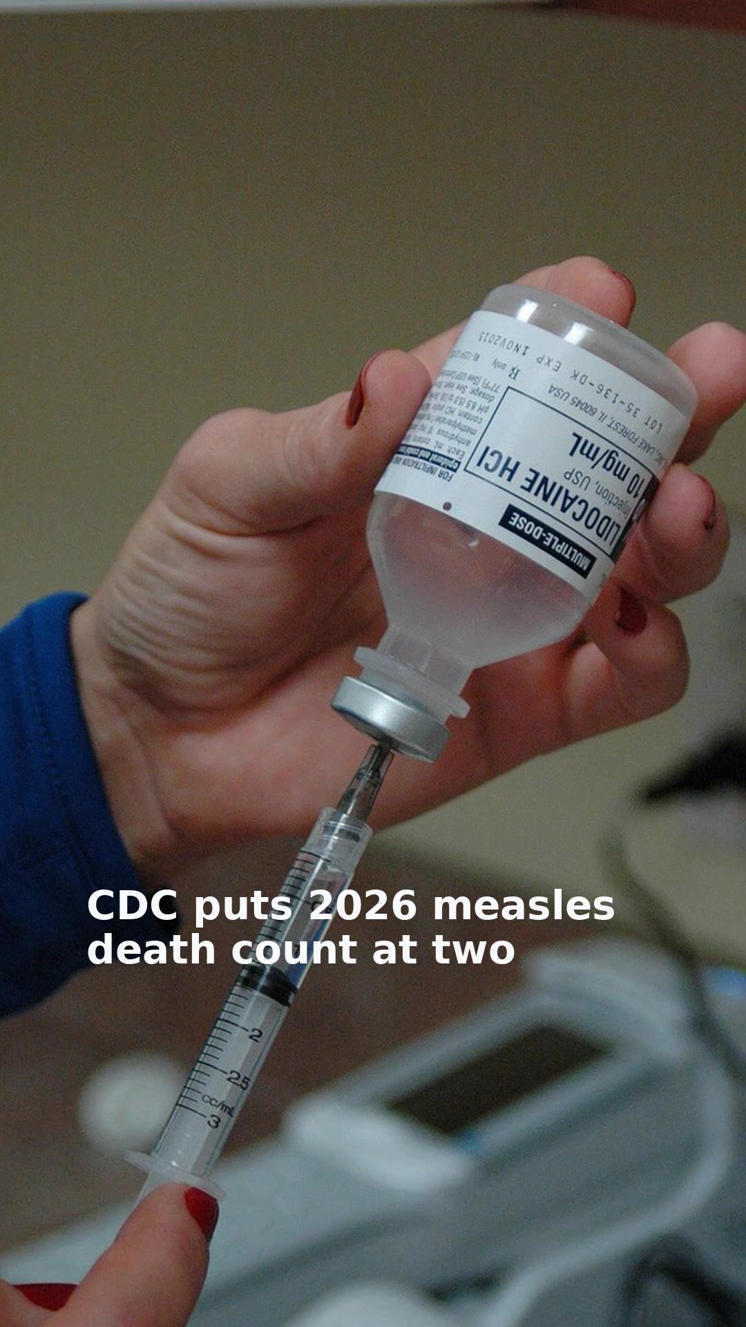 CDC puts 2026 measles death count at two