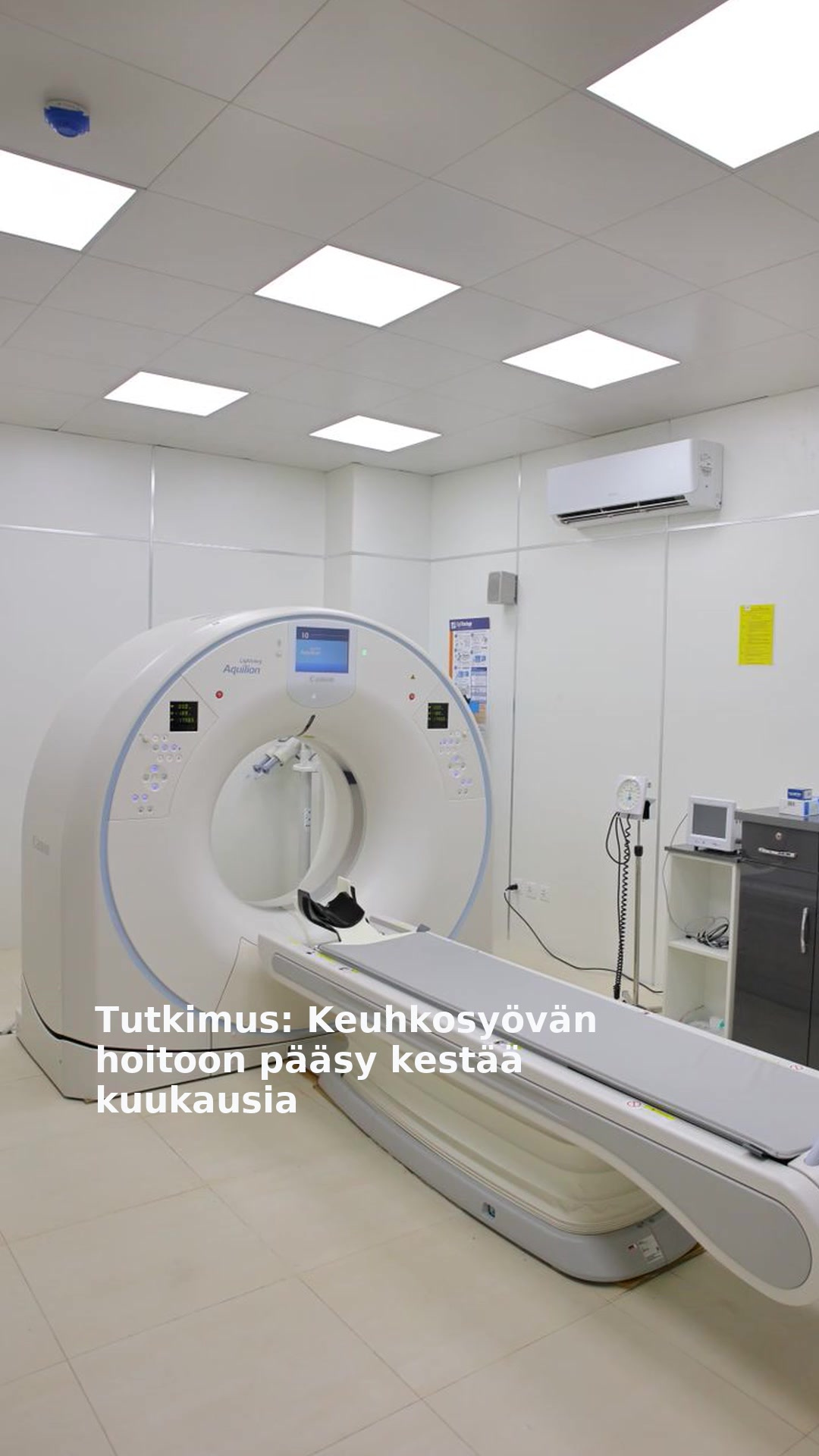Tutkimus: Keuhkosyövän hoitoon pääsy kestää kuukausia