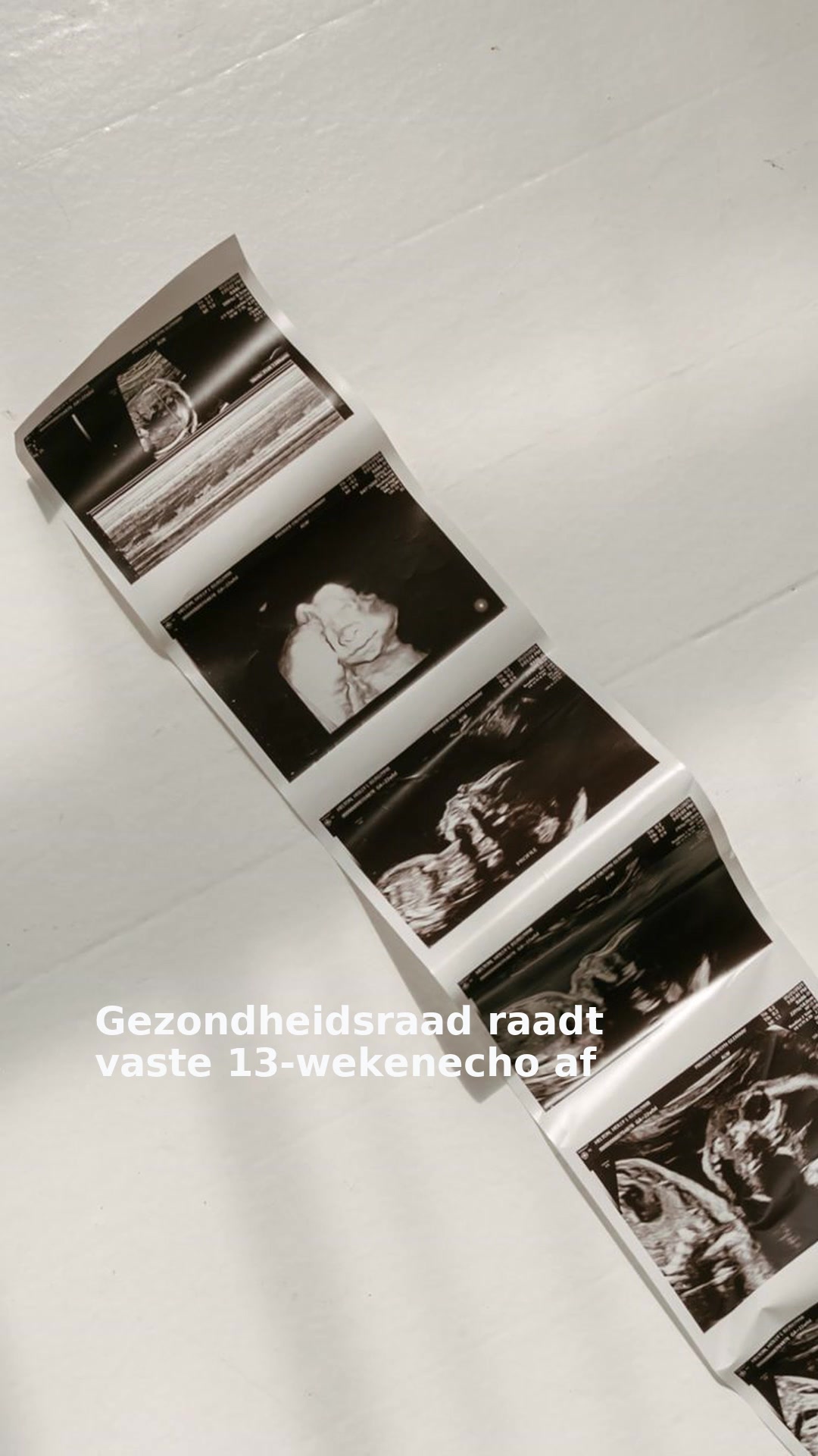 Gezondheidsraad raadt vaste 13-wekenecho af