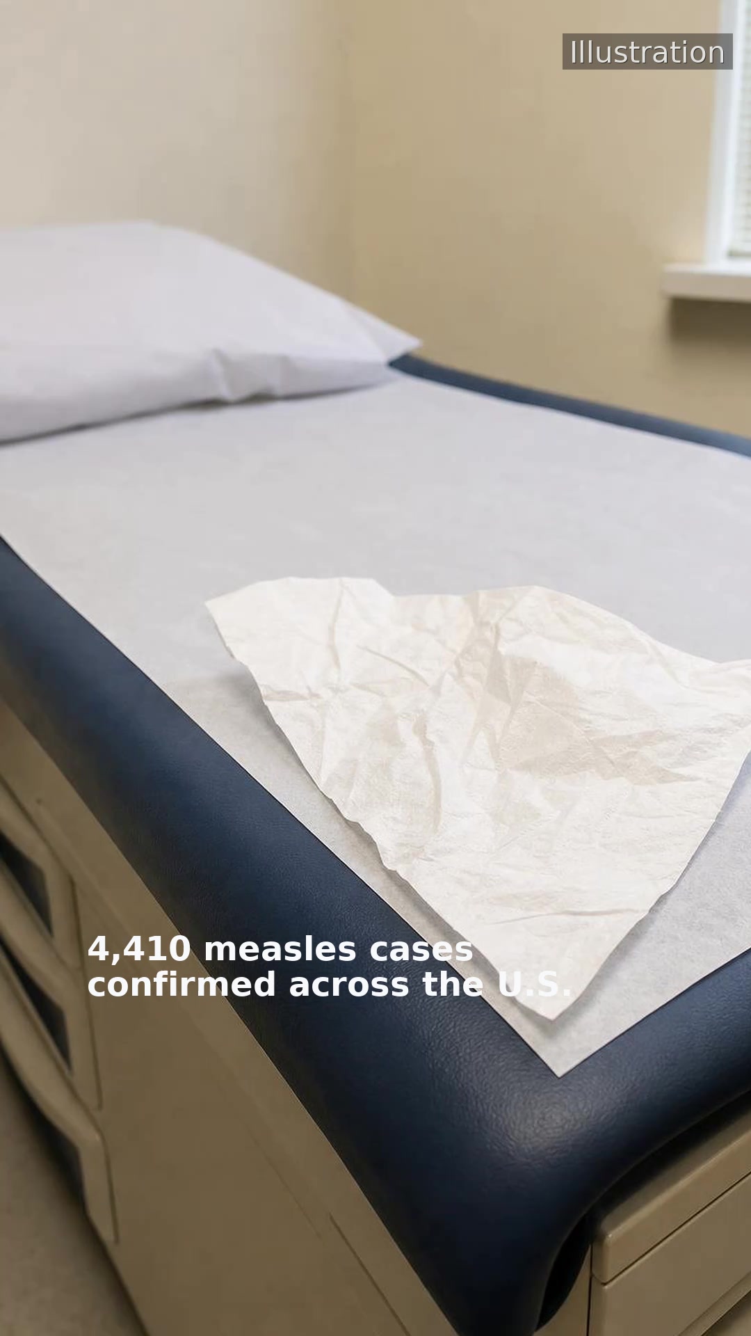 4,410 measles cases confirmed across the U.S.