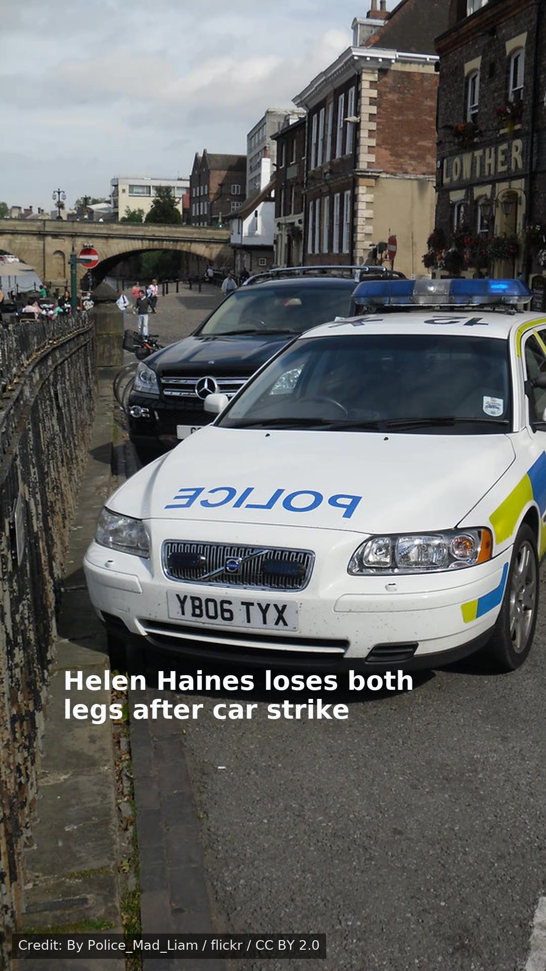 Helen Haines loses both legs after car strike