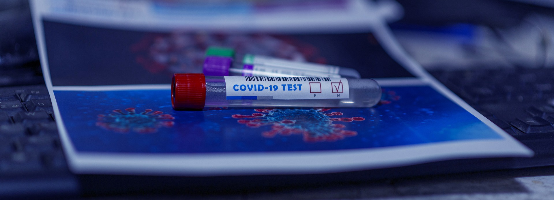 Covid-19: тесты могут выявить несуществующий вирус Covid-19: тесты могут выявить несуществующий вирус