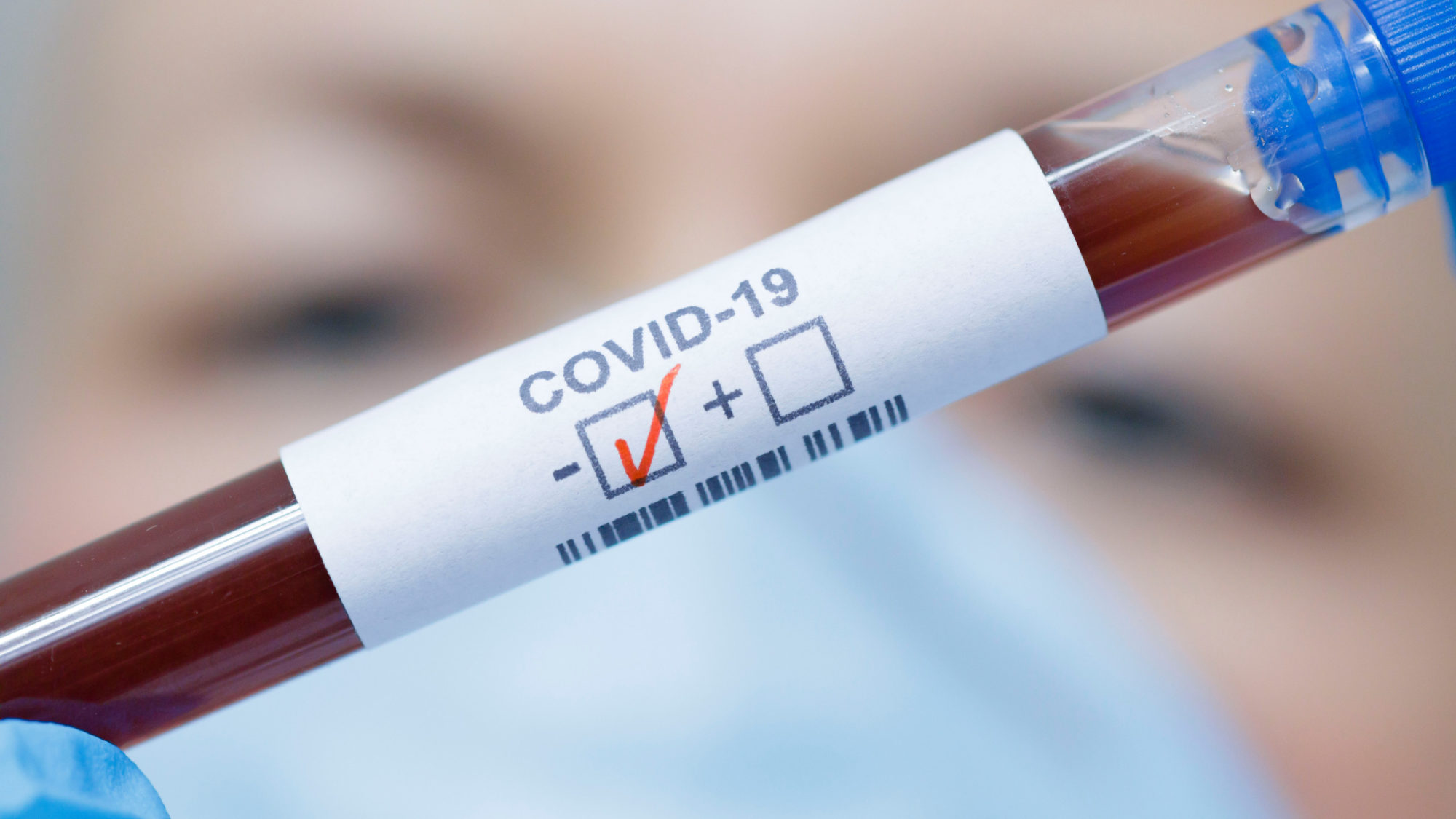 При въезде в Латвию нужно предъявить отрицательный тест на Covid-19