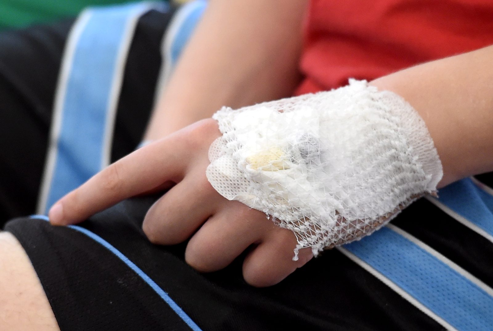 Baudot ziemas priekus, nedēļas nogalē traumas guvuši 110 bērni Baudot ziemas priekus, nedēļas nogalē traumas guvuši 110 bērni